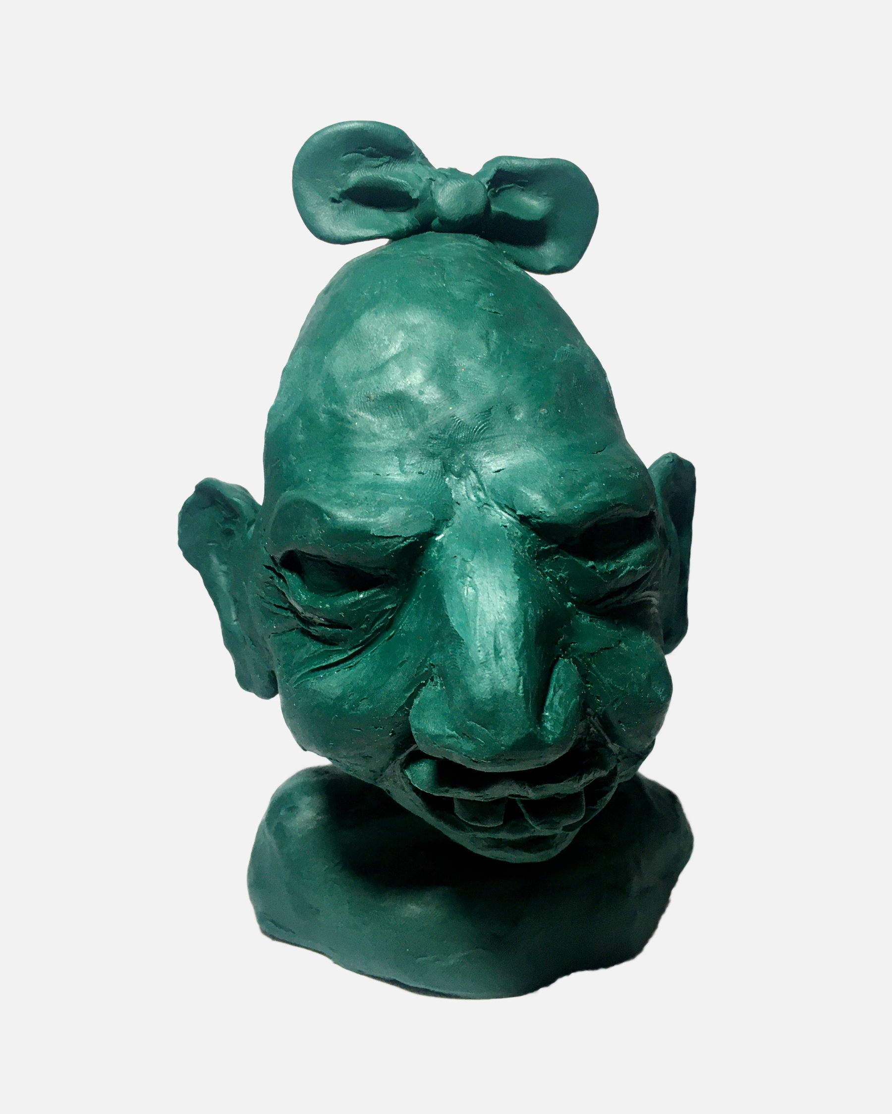 Cabeza con Microcefalia